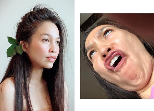 Sao viet lo anh xau xi anh 5