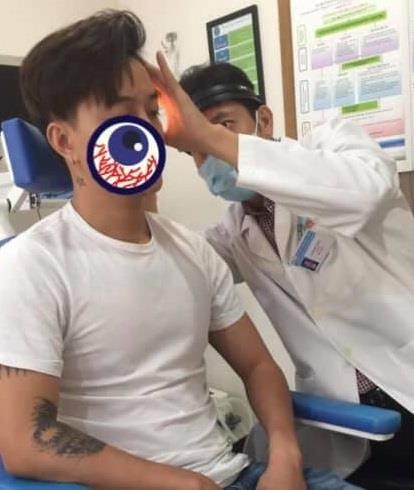 Ti Ti thủng màng nhĩ ảnh 1 Ti Ti thung mang nhi anh 1