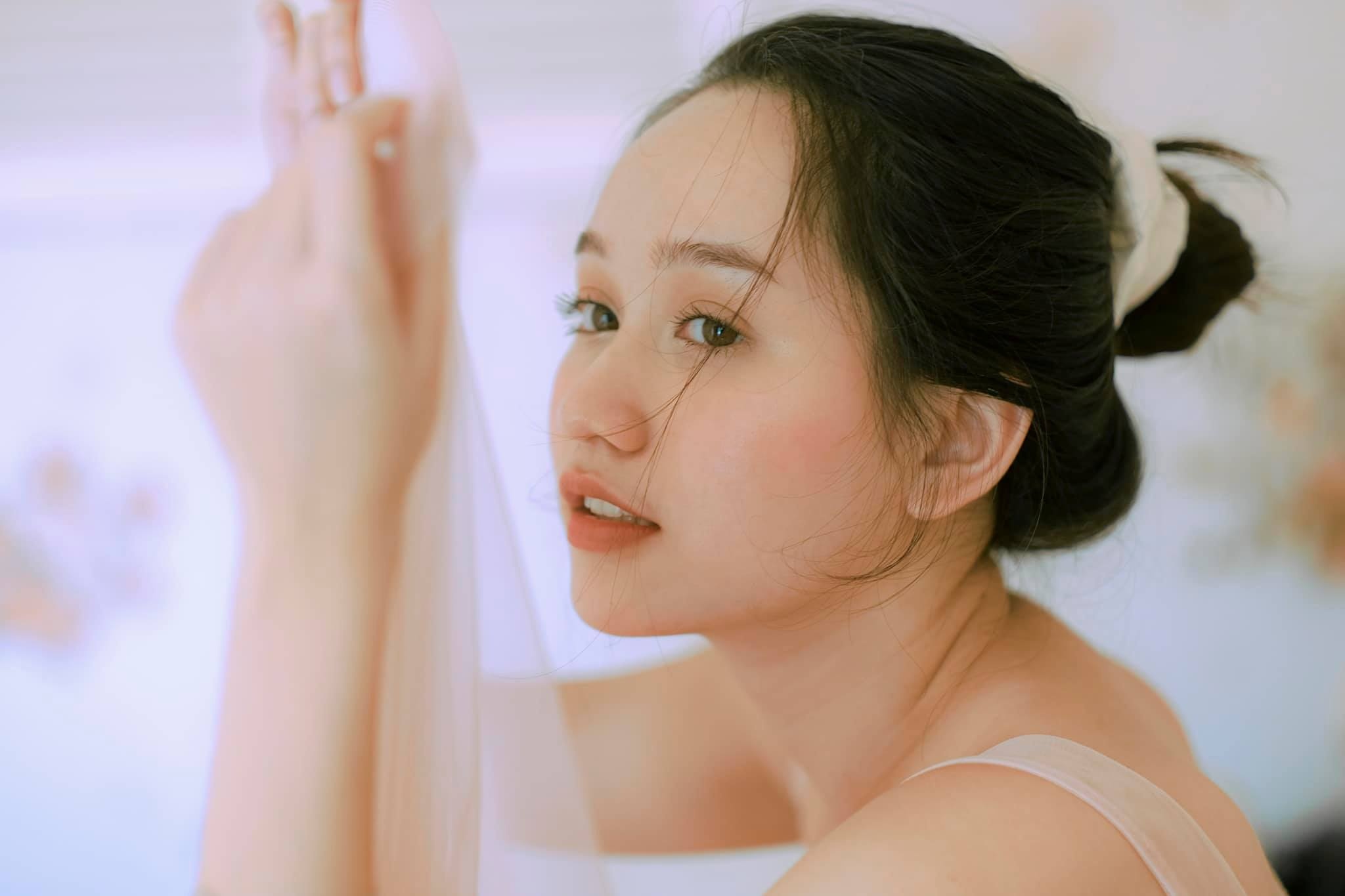 Ha Lan 'Mat biec': 'Toi tung muon phau thuat tham my' hinh anh