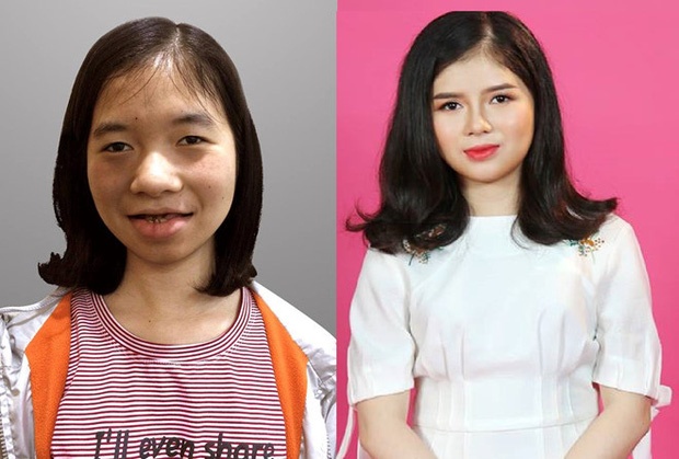 phau thuat tham my anh 2