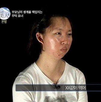 phau thuat tham my anh 5