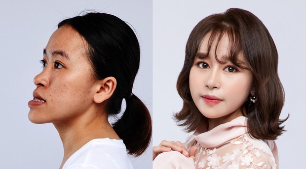 phau thuat tham my anh 3