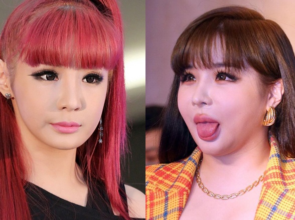 Park Bom truoc khi lo mat sung phu bien dang hinh anh