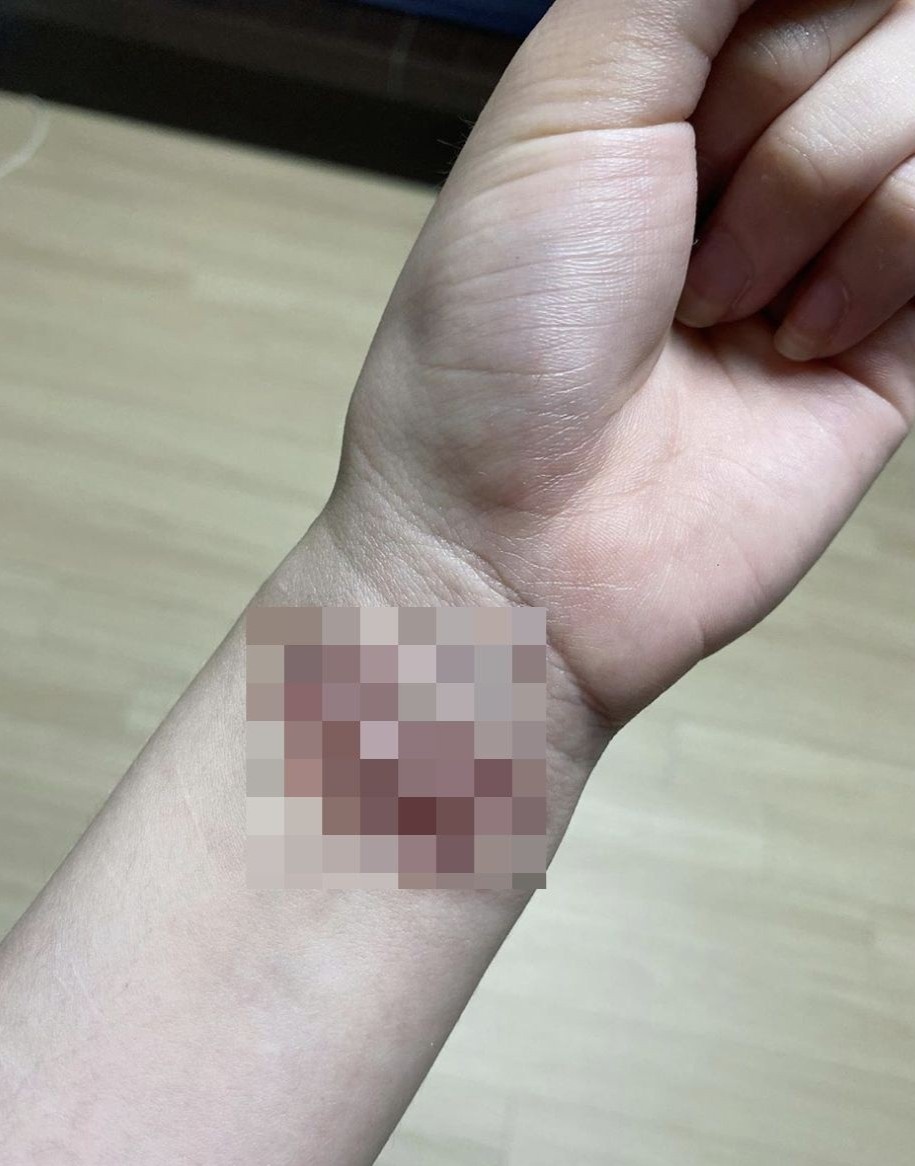 Ca sĩ hàn bị bắt nạt ảnh 3 Ca si han bi bat nat anh 3