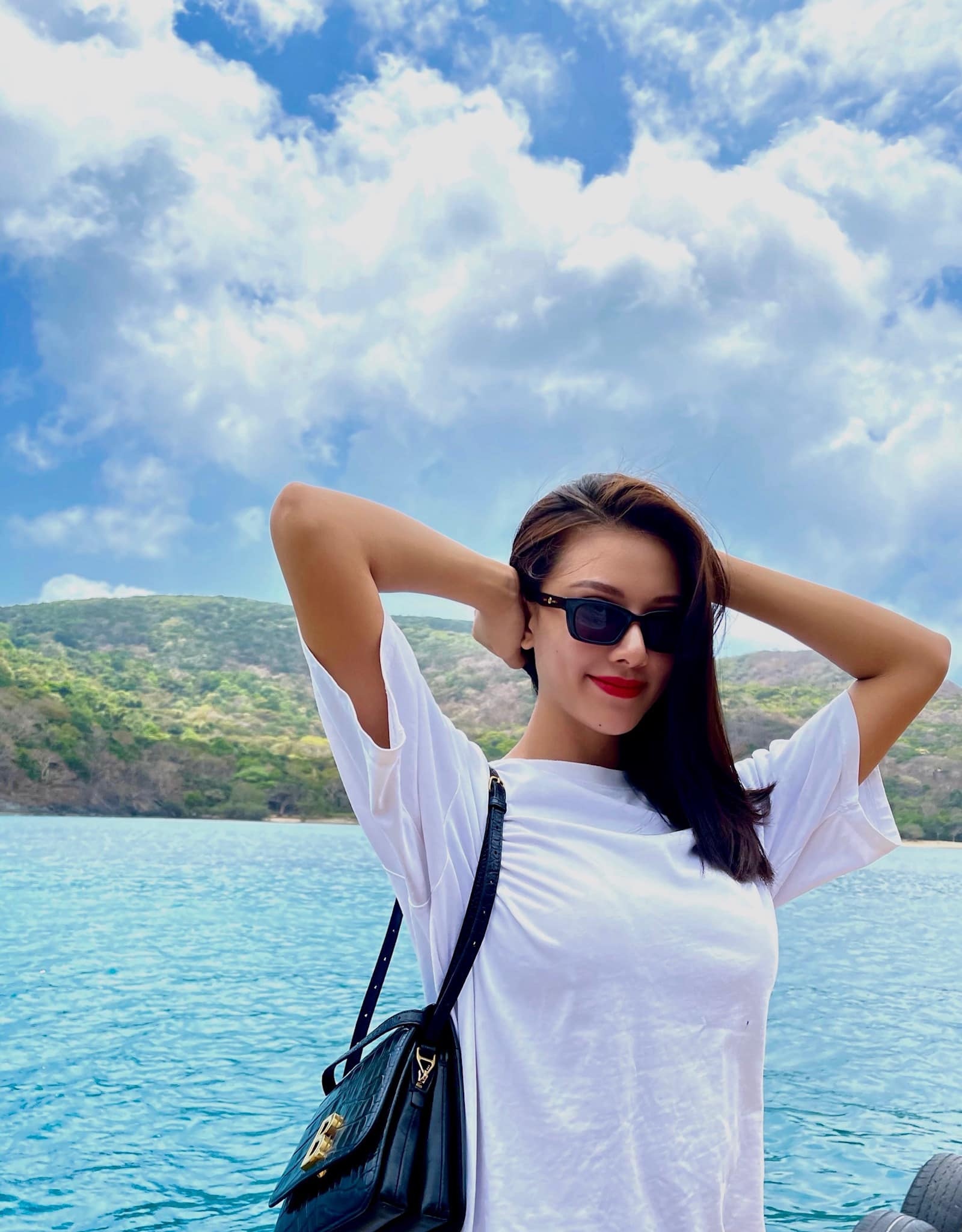 kim duyên phẫu thuật thẩm mỹ ảnh 1 kim duyen phau thuat tham my anh 1