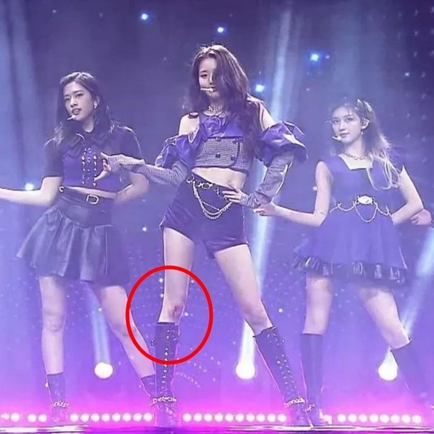 Jang Won Young bi thuong anh 2