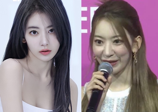 Nu ca si Sakura bi nghi phau thuat tham my hinh anh