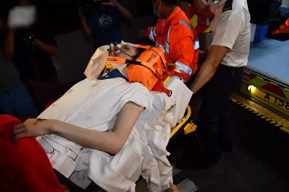 vu cong bi den led roi trung anh 1