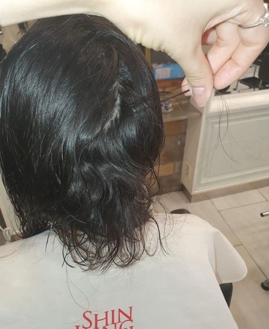 ca sĩ bị chồng đánh ảnh 2 ca si bi chong danh anh 2