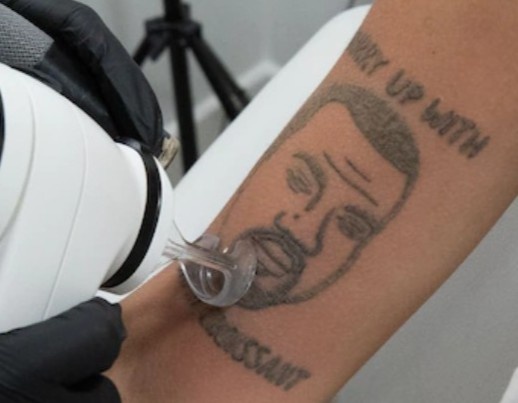 Xoa mien phi hinh xam Kanye West hinh anh