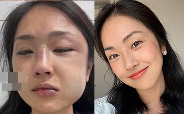 MC Mi Soa Kim Anh to bi hanh hung hinh anh