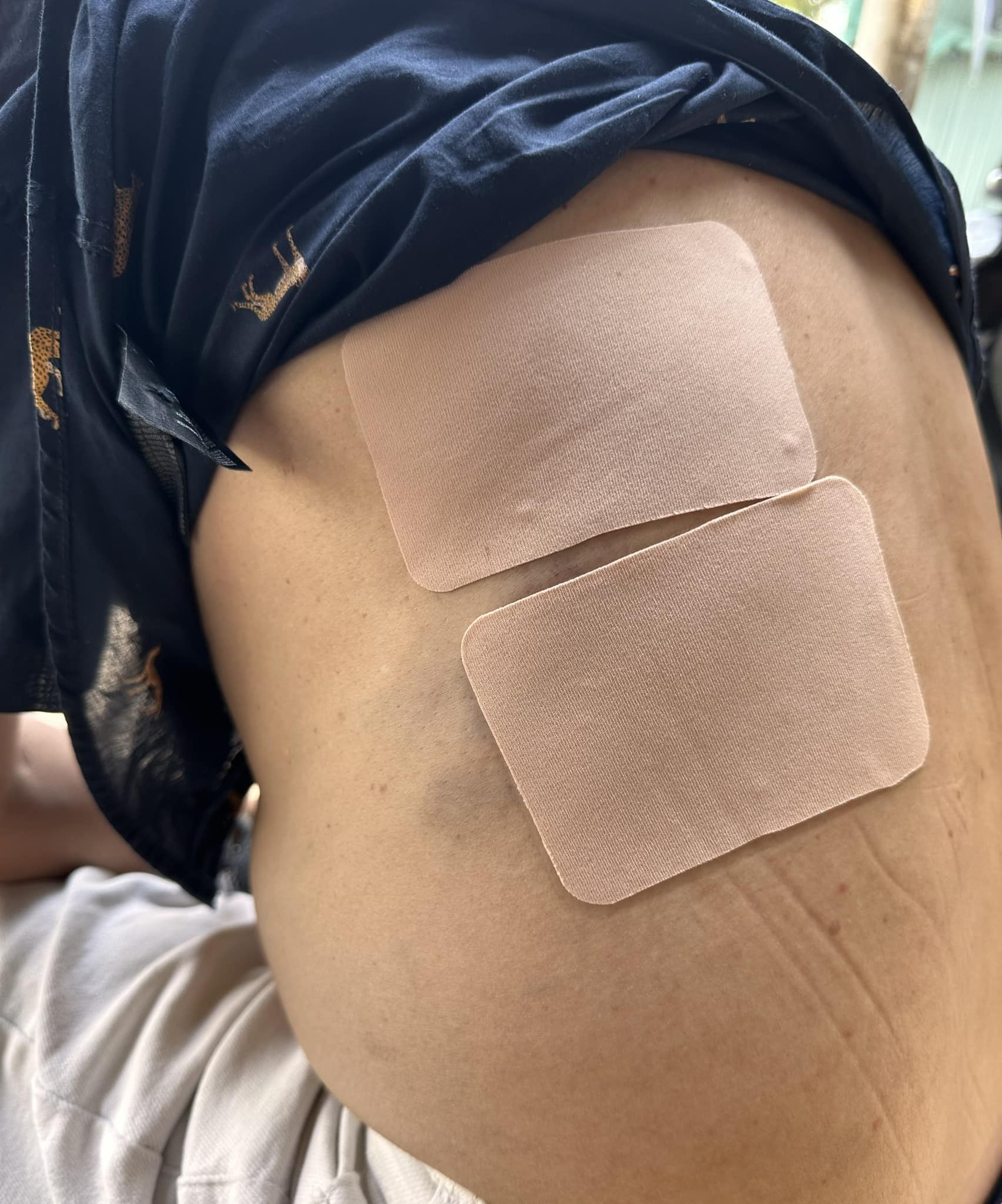 Tan Beo bi thuong anh 2