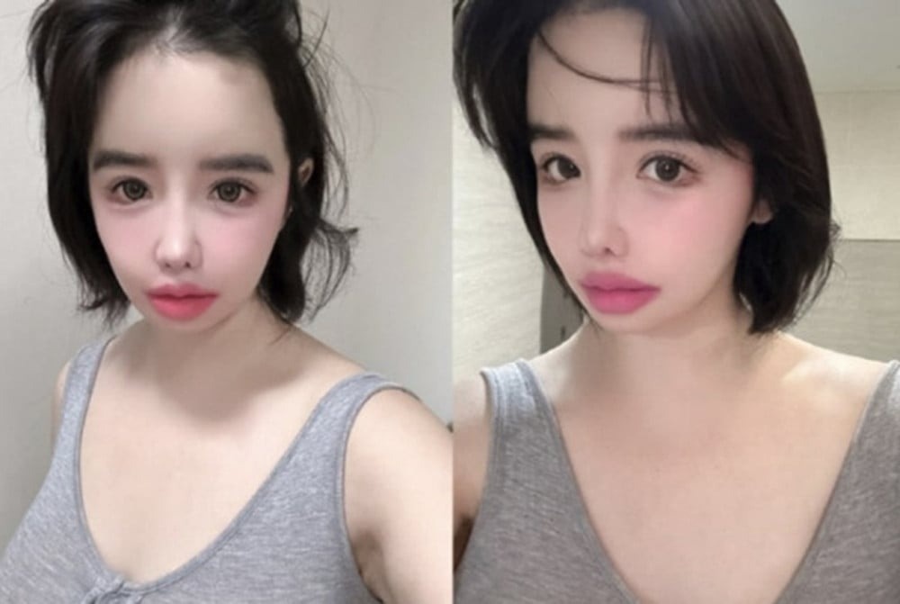 Park Bom dung hoat dong hinh anh