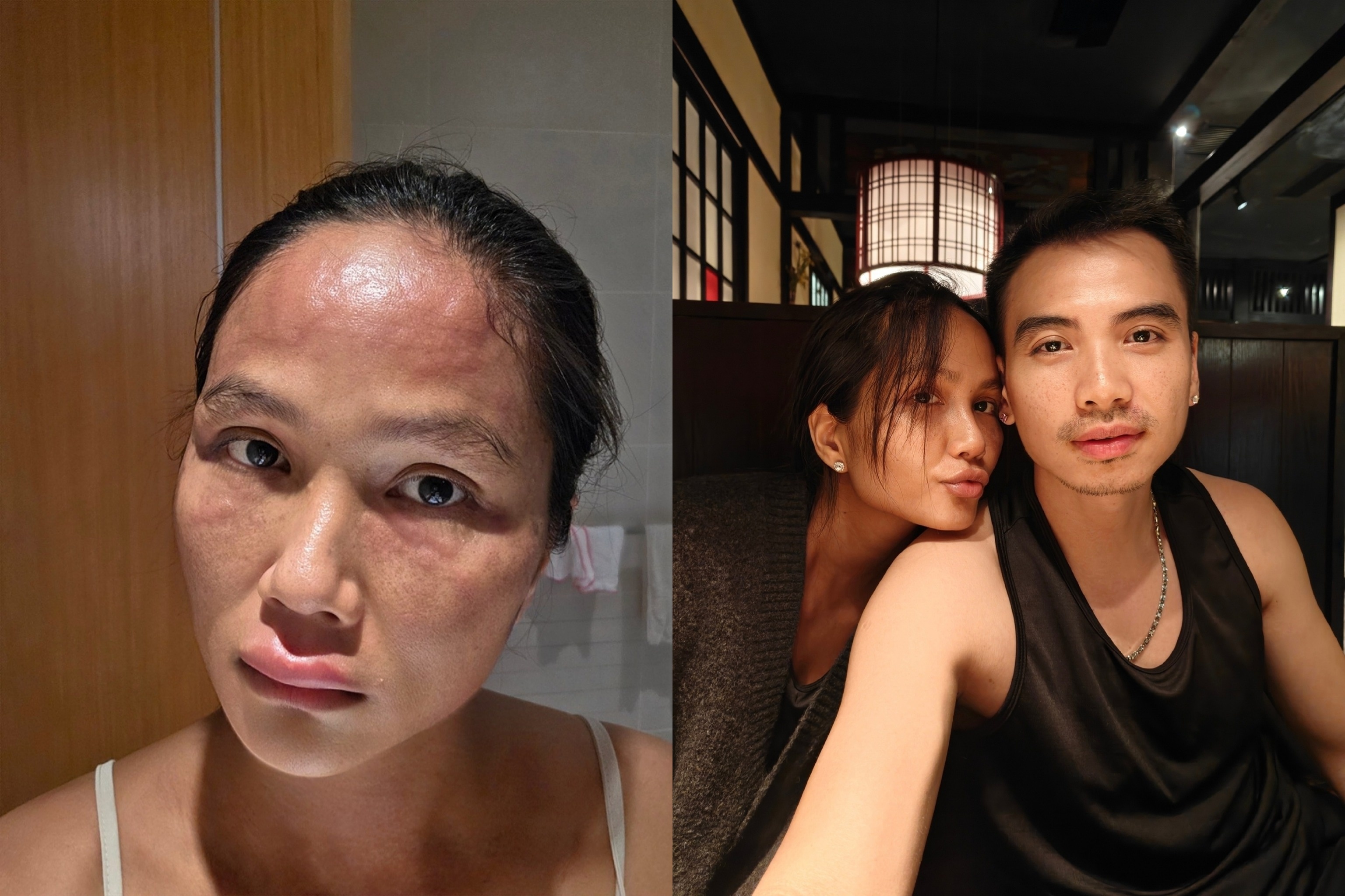 Tinh trang H'Hen Nie hien tai hinh anh