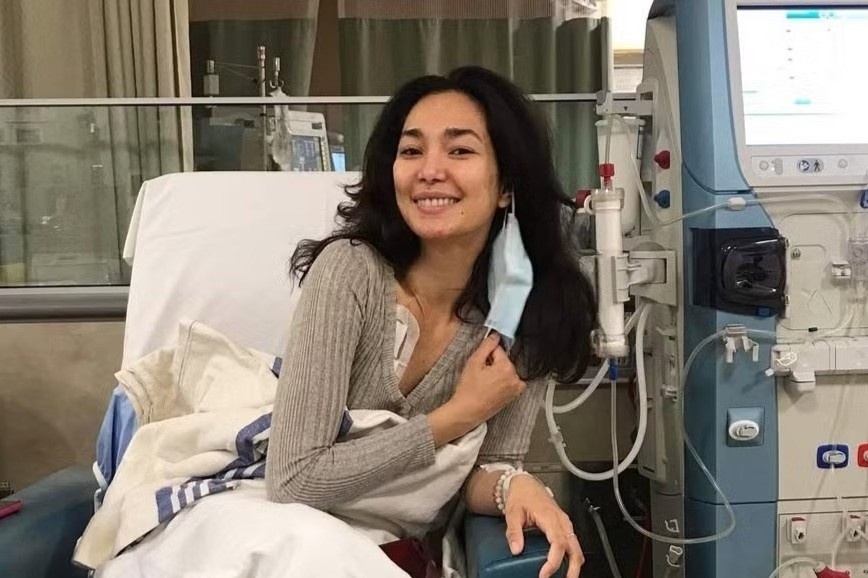 Tinh trang cua hoa hau phai loc mau, ghep than hinh anh