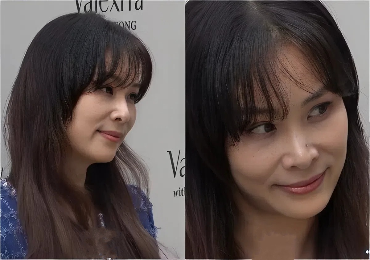 Ko So Young ảnh 1
