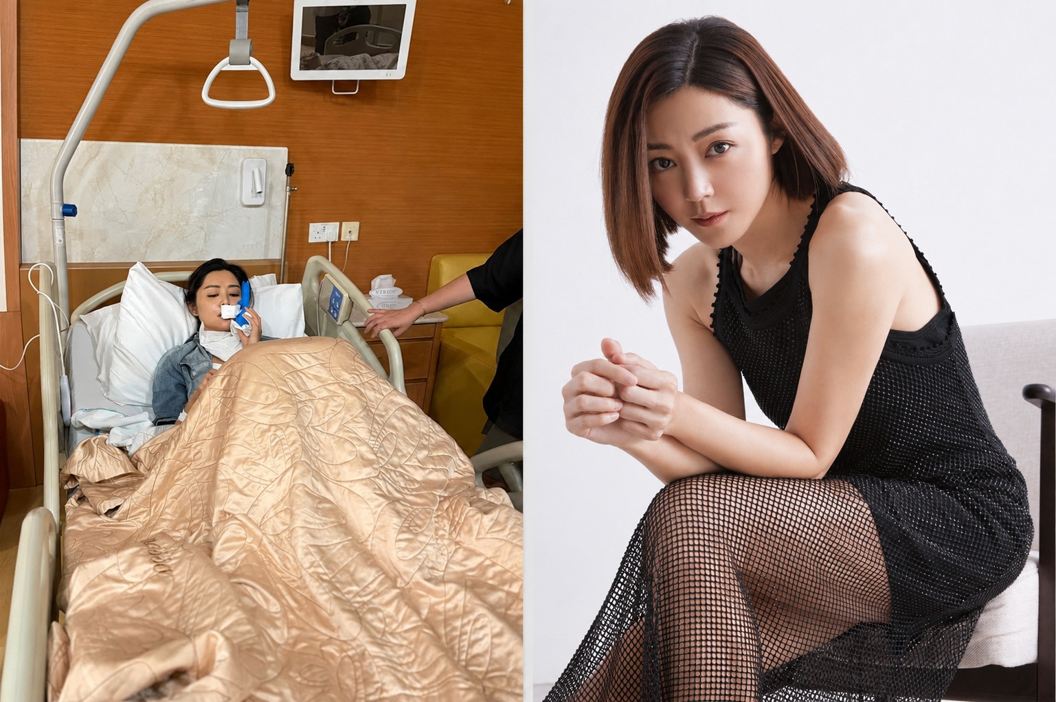 Diễn viên Vệ Thi Nhã bị tai nạn, khâu 50 mũi