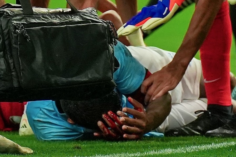 Hai cau thu Campuchia nhap vien sau tran thua Singapore hinh anh