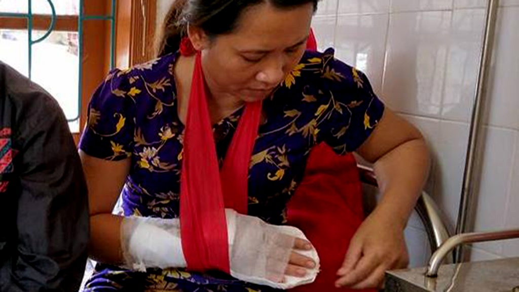 Khoi to thanh nien chem nhan vien y te vi bi tu choi truyen nuoc hinh anh