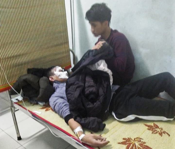 nam sinh dùng lửa đốt thử xăng ảnh 1 nam sinh dung lua dot thu xang anh 1