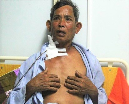 dung dao dam hang xom anh 1