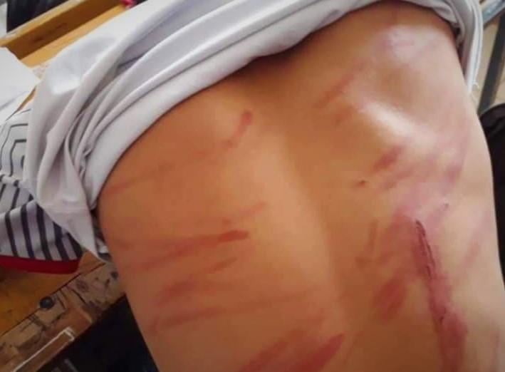 Nam sinh lop 8 bi bo danh bam tim, ngat xiu tai lop hoc hinh anh