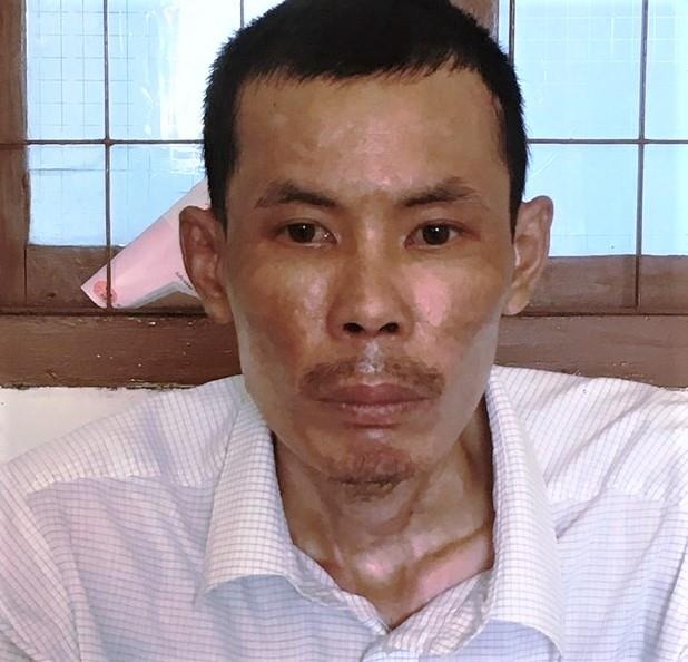 chong tuoi xang dot vo anh 1