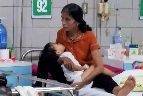 Rắn hổ mang cắn gây hoại tử chân ảnh 1 Ran ho mang can gay hoai tu chan anh 1