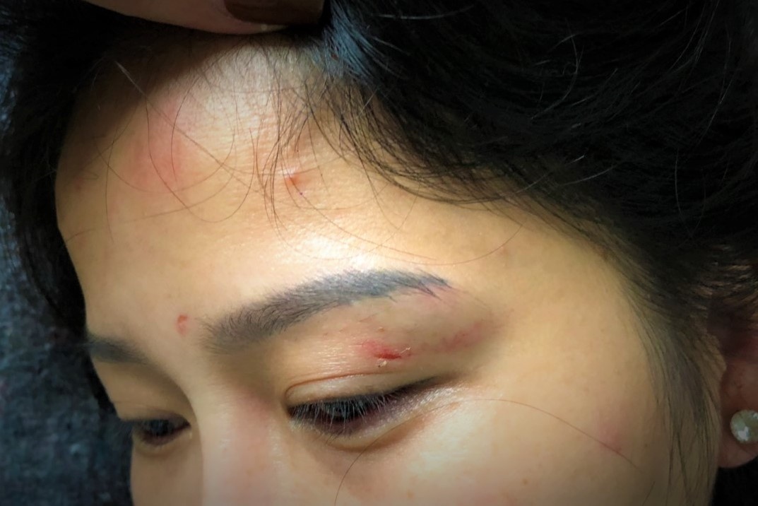 Hành hung vợ cũ ảnh 2 Hanh hung vo cu anh 2