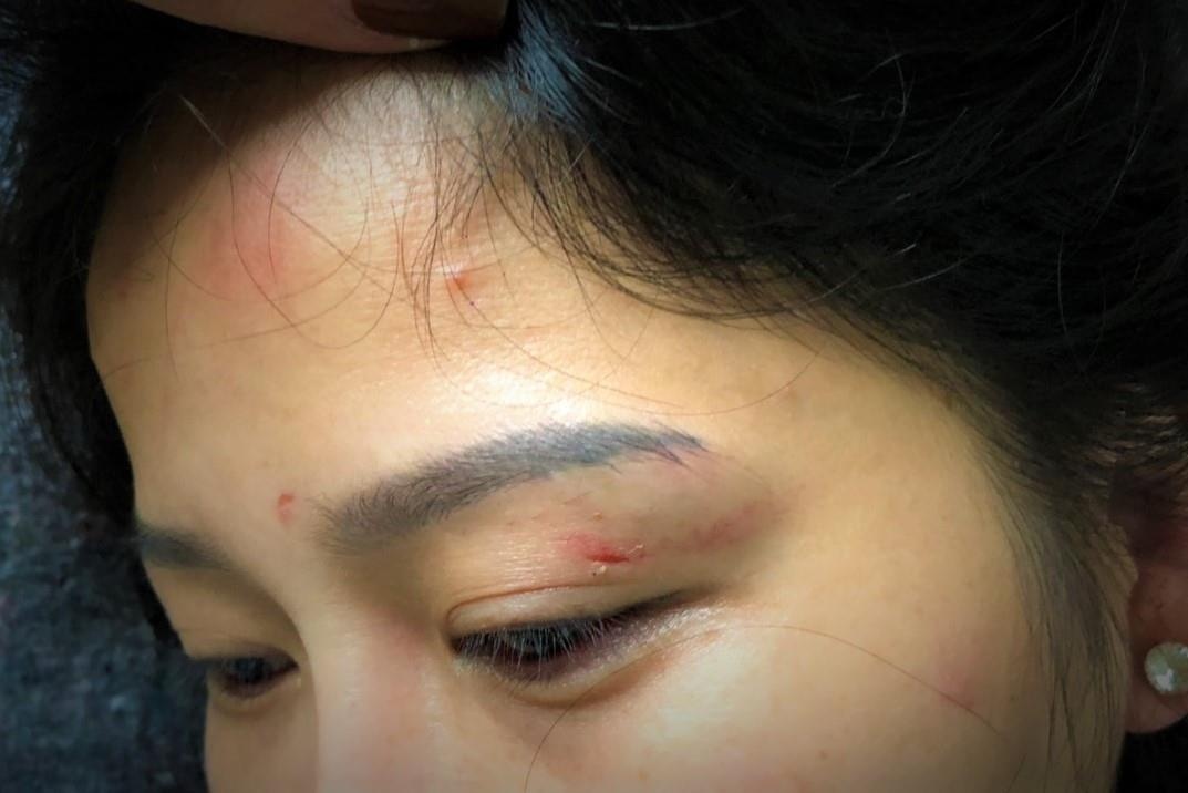 Cuu can bo cong an danh vo cu bi bat giam hinh anh