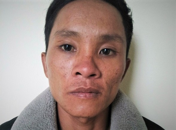 cố ý gây thương tích ảnh 1 co y gay thuong tich anh 1