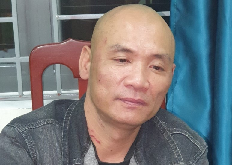 Dai uy canh sat gay ngon tay khi khong che ke con do hinh anh