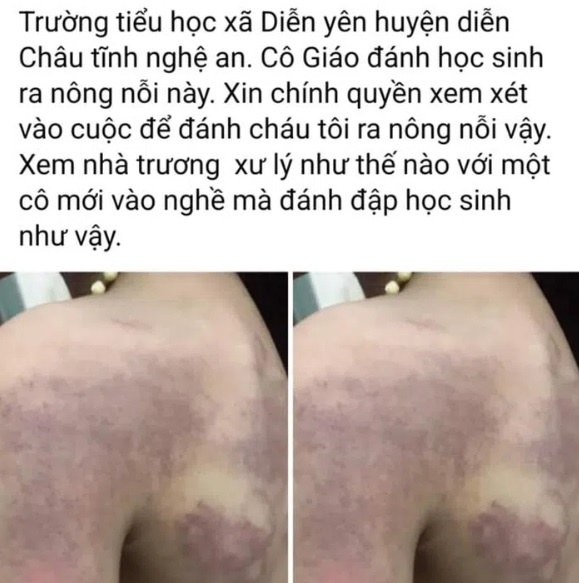 học sinh bị đánh ảnh 1 hoc sinh bi danh anh 1