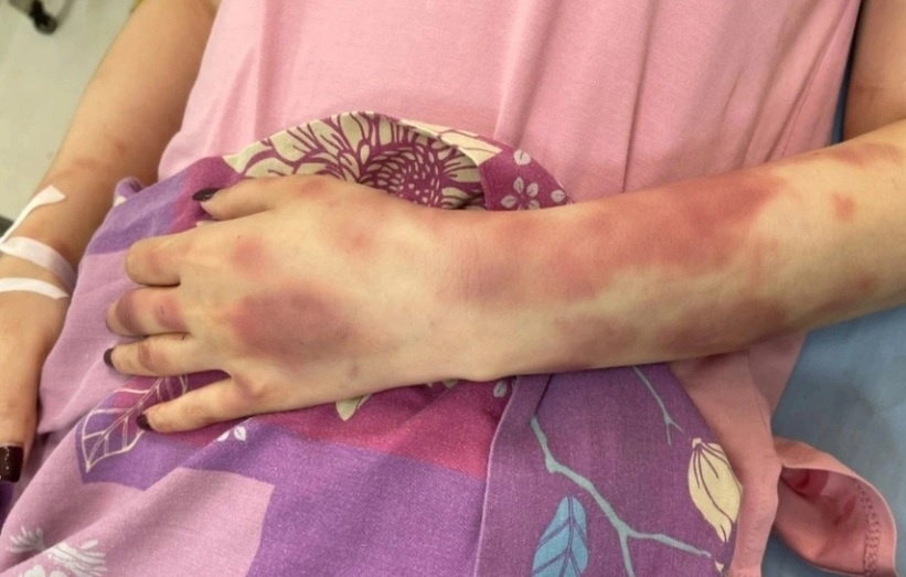 Can bo QLTT giai thich viec danh ban gai vi qua yeu hinh anh