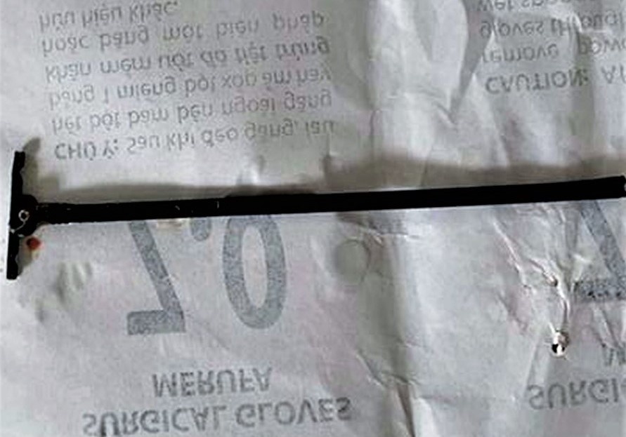 Be gai 4 tuoi bi thanh sat dam xuyen mieng hinh anh