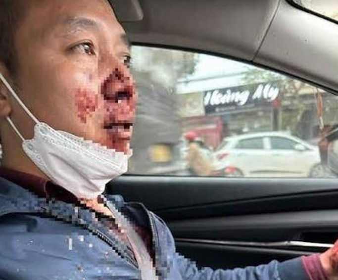 Giao vien bi chan duong, cuop 900.000 dong hinh anh