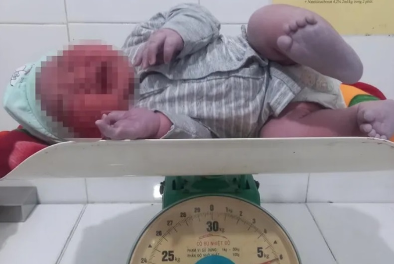 Be trai chao doi nang 6 kg hinh anh