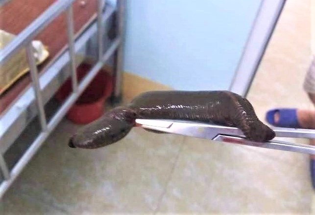 Nguoi dan ong bi dia dai 15 cm chui vao vung kin hinh anh