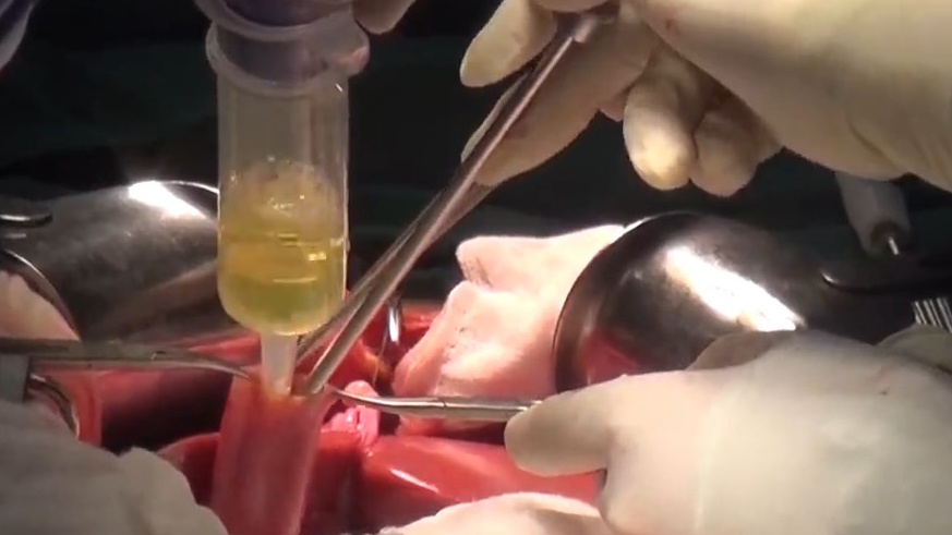 Goc khuat nghe bac si van dong hien tang hinh anh