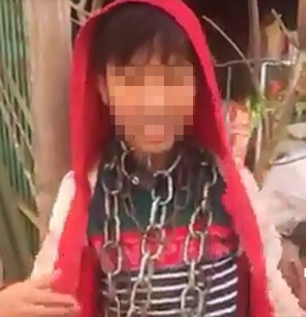 Trieu tap chu ruot quan xich vao co be trai 10 tuoi o Thanh Hoa hinh anh