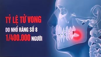 Than trong khi nho rang khon so 8 hinh anh