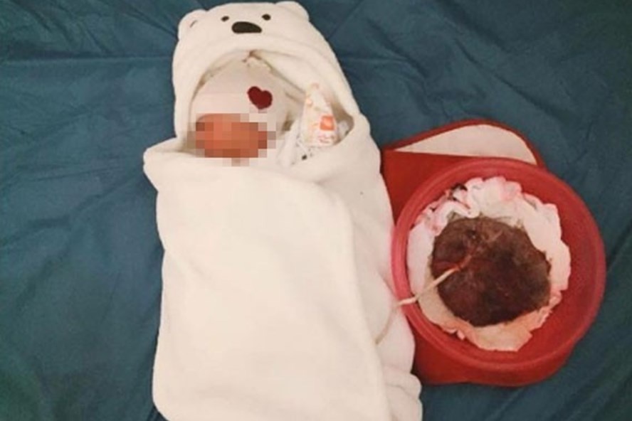 Hieu dung ve trao luu 