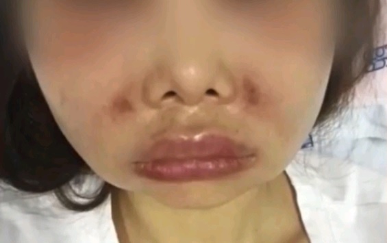 Co gai gap bien chung khung khiep khi bom moi o TP.HCM hinh anh