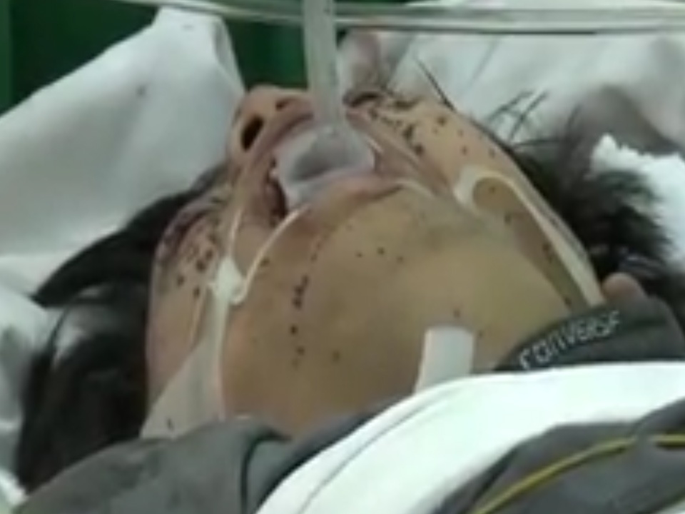 Hang tram nan nhan vu chay chung cu da duoc dua vao 5 benh vien hinh anh