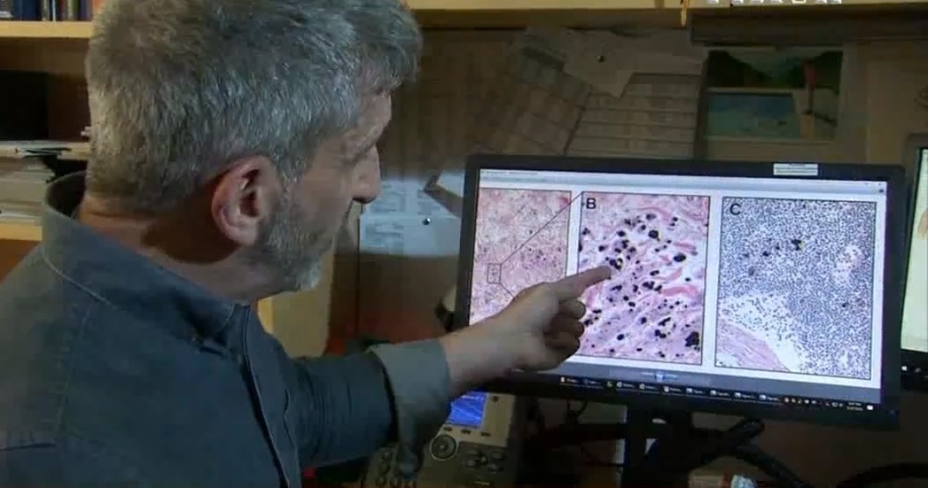 Phat hien bo phan moi trong co the con nguoi hinh anh