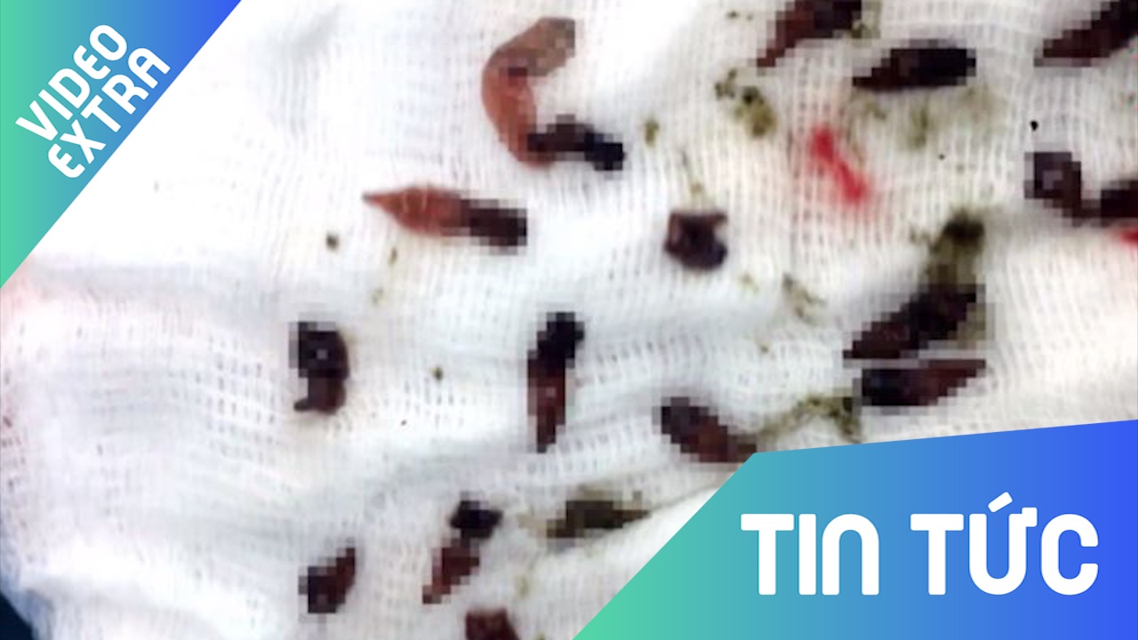 Gap 800 con san la gan trong ong mat nguoi hay an goi ca o Dong Nai hinh anh