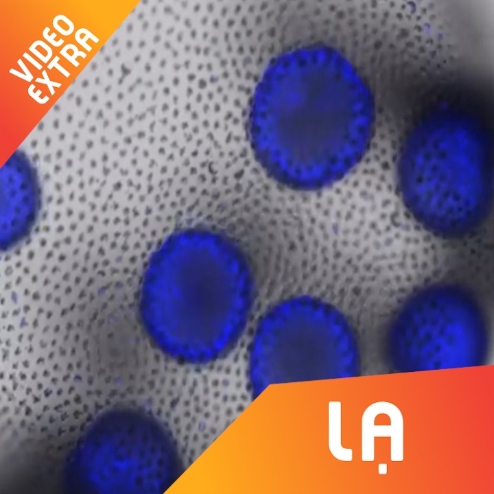 Nhung hinh anh la lam cua cac sinh vat duoi kinh hien vi hinh anh