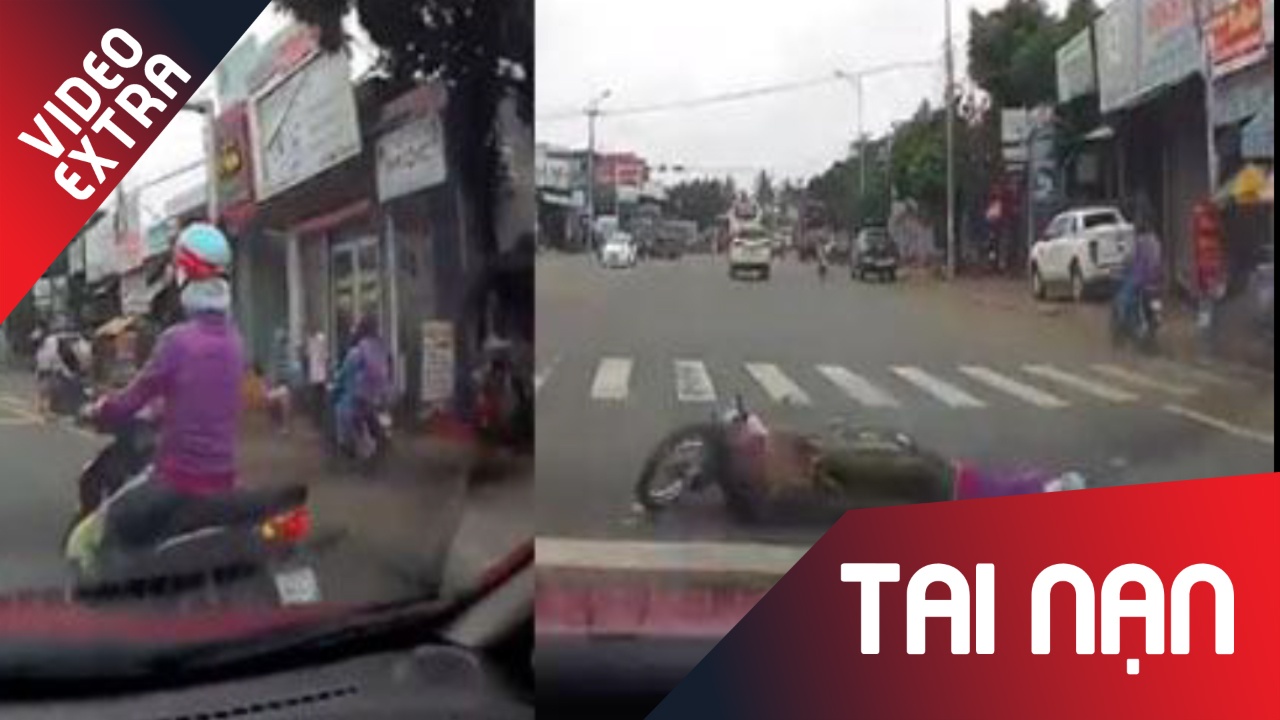 Co gai sang 'nam duong' sau khi bi oto tong vi re au hinh anh