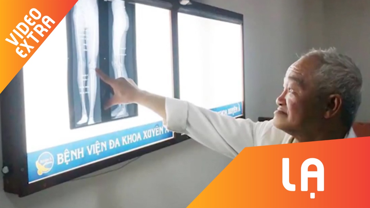 Keo dai chan 4,2 cm, chang trai Ca Mau lan dau di duoc thang bang hinh anh