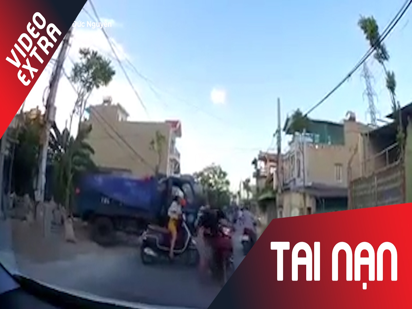 Qua duong khong quan sat, co gai gay tai nan roi than nhien bo di hinh anh